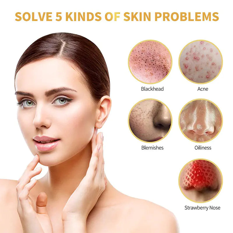 4K Gold Peel-Off Blackhead Mask