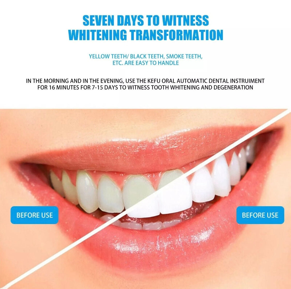 Dental LED Whitening Lamp