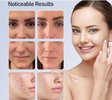 7-Color LED Facial Mask for Skin Care (Single Unit)